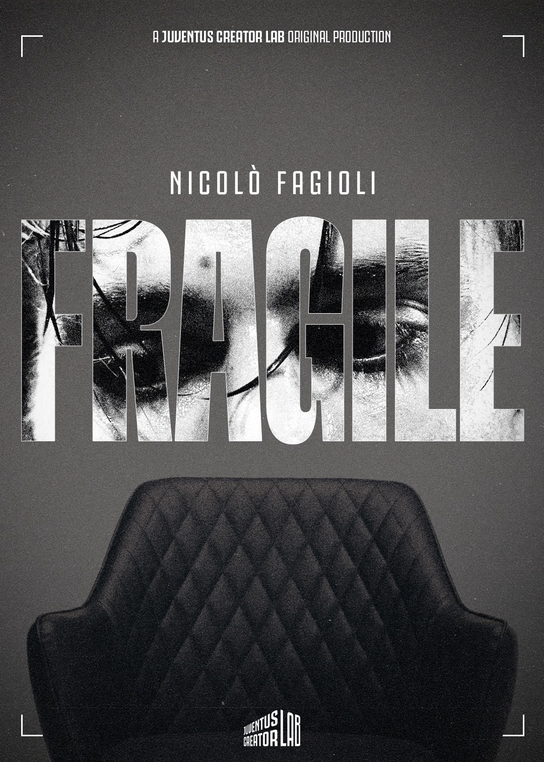 Juventus, infortunio per Conceicao: presentato il film di Fagioli