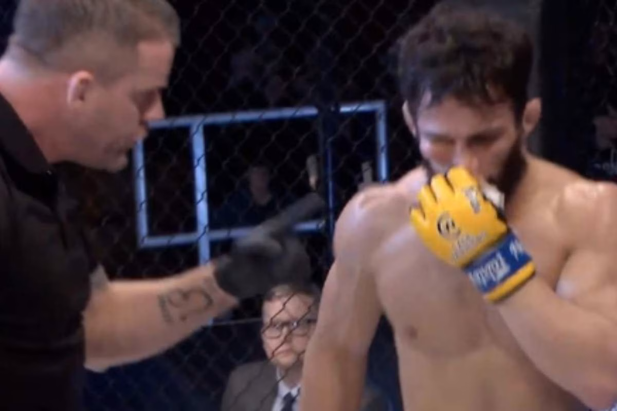 Ermil Xhaferi con l'occhio gonfio