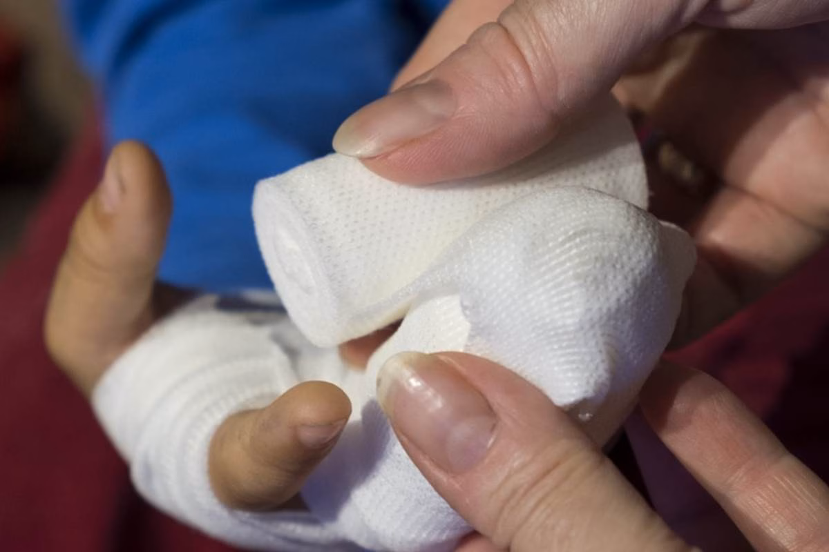 Infortunio alla mano