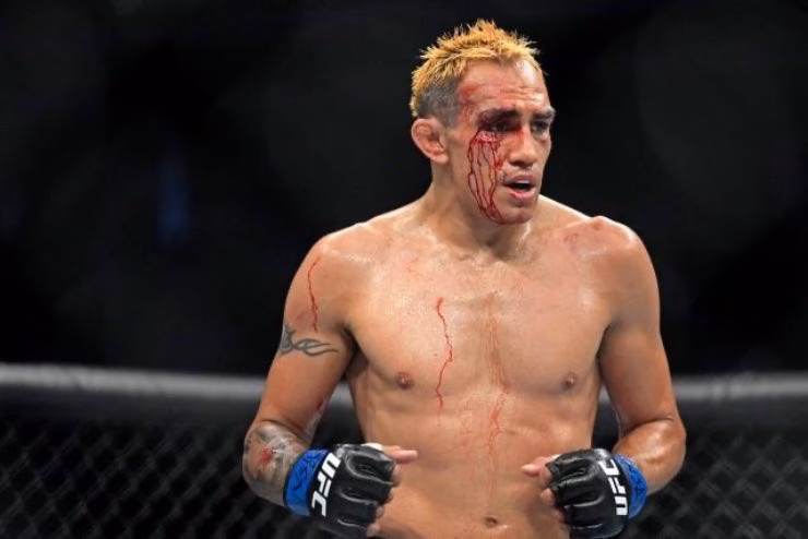 Tony Ferguson pugilato 